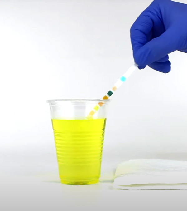 Urine Strip Multi Parameters